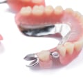 Temporary Fixes for Emergencies: How to Handle Denture Repairs on Your Own