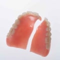 Worn or Broken Clasps: A Guide to Denture Repair and Maintenance