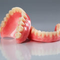 Exploring the World of Traditional Complete Dentures