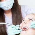 Maximizing Insurance Benefits for Dentures