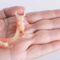 Understanding the Benefits of Flexible Partial Dentures