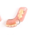 Signs of Wear and Tear on Dentures