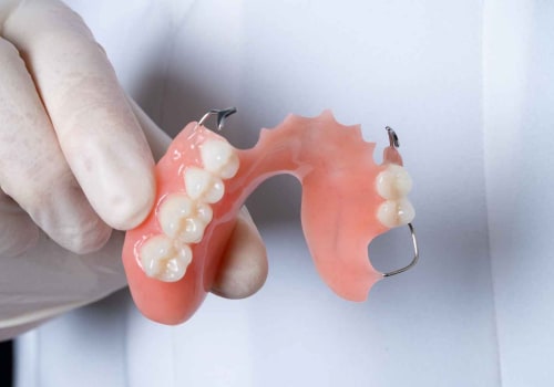 The Benefits of Acrylic Partial Dentures