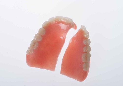 Worn or Broken Clasps: A Guide to Denture Repair and Maintenance