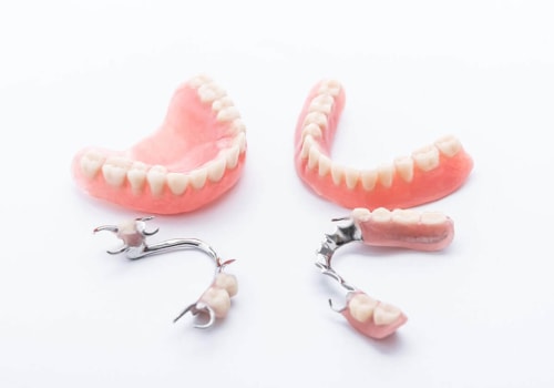 How to Care for Snap-On Dentures: A Comprehensive Guide to Keeping Your Dentures Clean and Functional