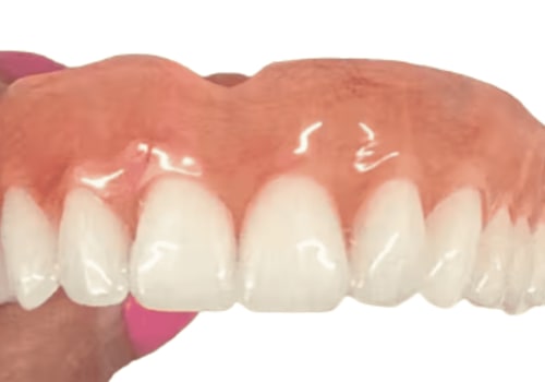 Alternative Payment Options for Dentures: A Comprehensive Guide